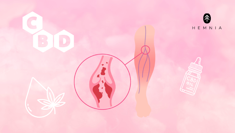 CBD products hleping with varicose veins 