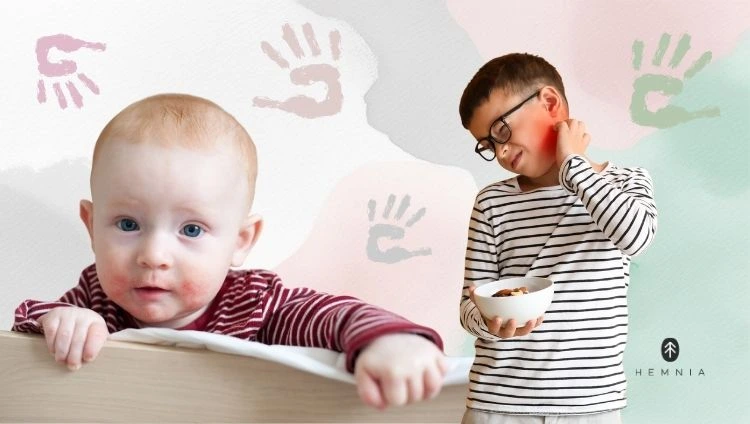 Bērni ar atopisko ekzēmu, Hemnia logotips apakšējā labajā stūrī